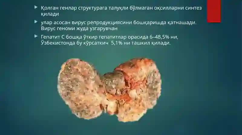 СУРУНКАЛИ ГЕПАТИТЛАР 4