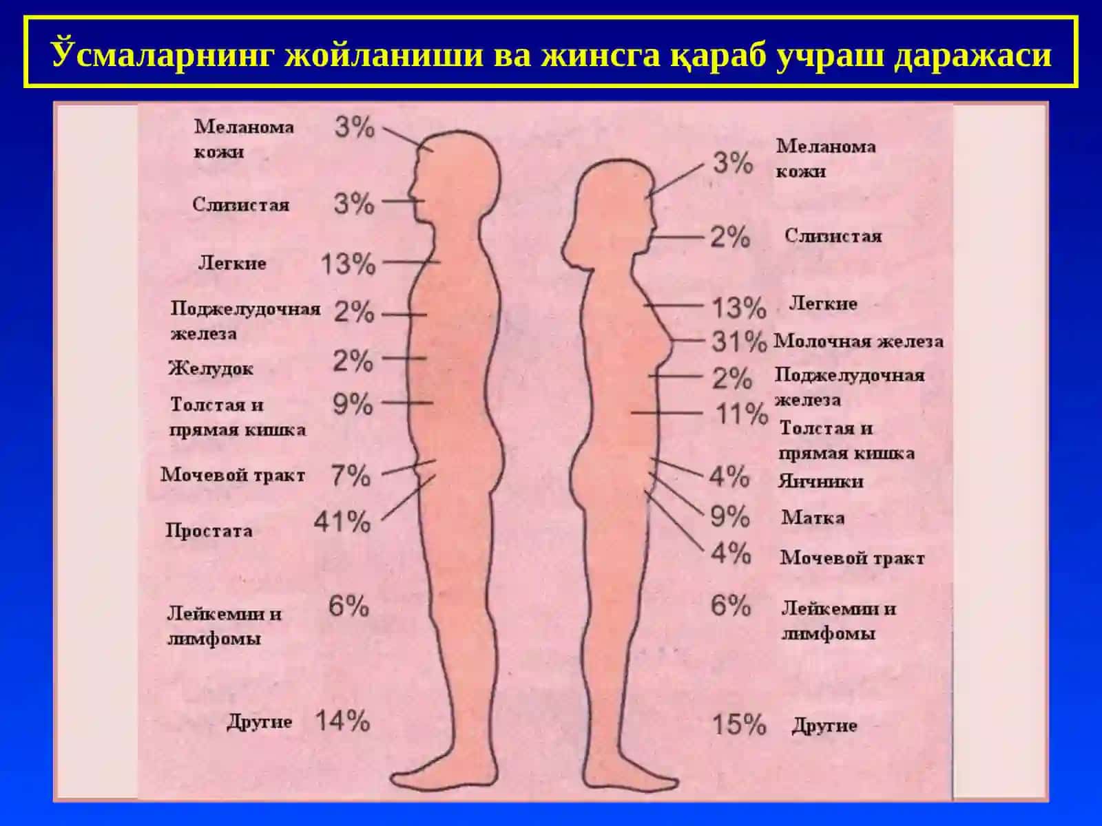 ПАТОЛОГИК АНАТОМИЯ “Ўсмалар, умумий тушинчалар. Эпителий ўсмалари” 4