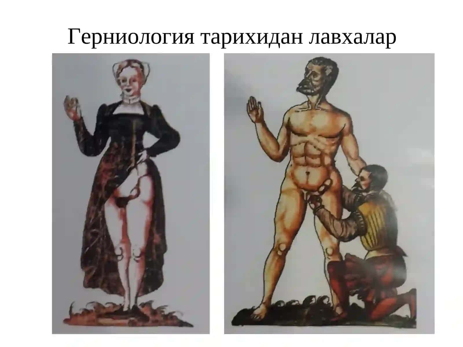 Чурралар ва унинг асоратлари 4