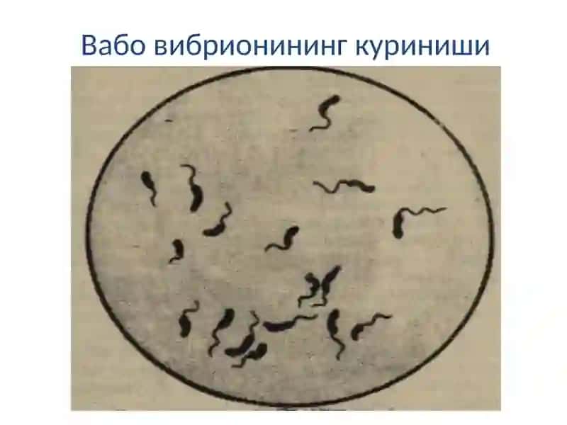 Вабо (cholera) 4