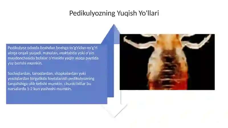 Pedikulyoz: Kelib Chiqishi va Yuqishi Yo'llari 4