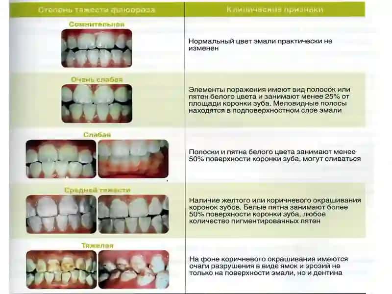 Профилактика некариозных поражений 4