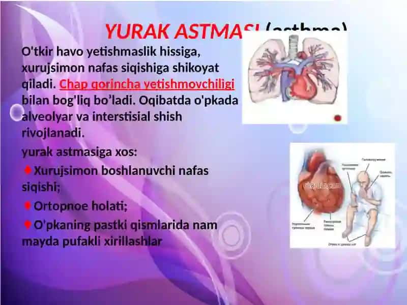 Yurak qon-tomir kasalligi bilan ogʻrigan bemorlarni tekshirish usullari 4