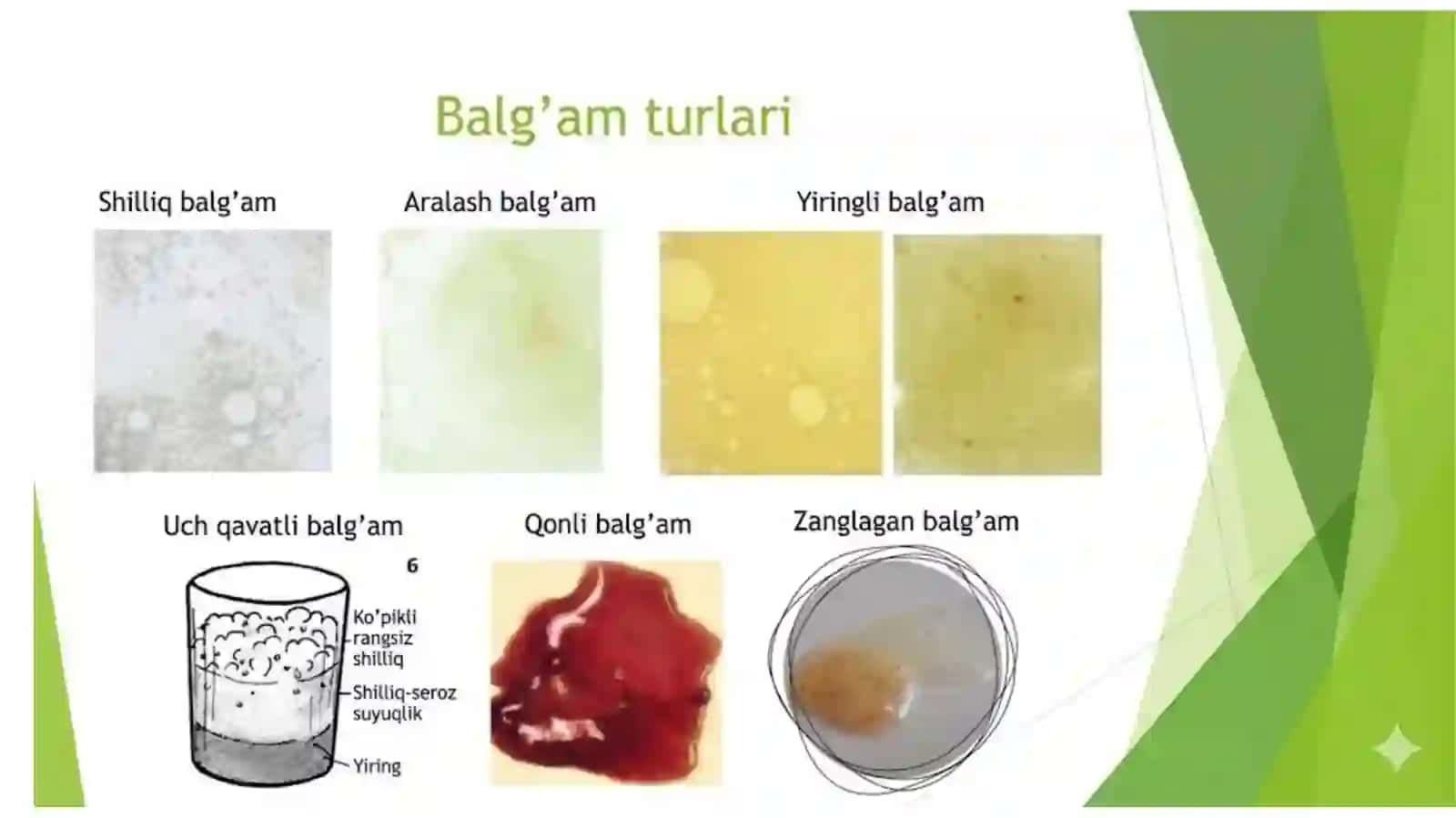 Balg‘am bo‘yicha differensial diagnostika 4