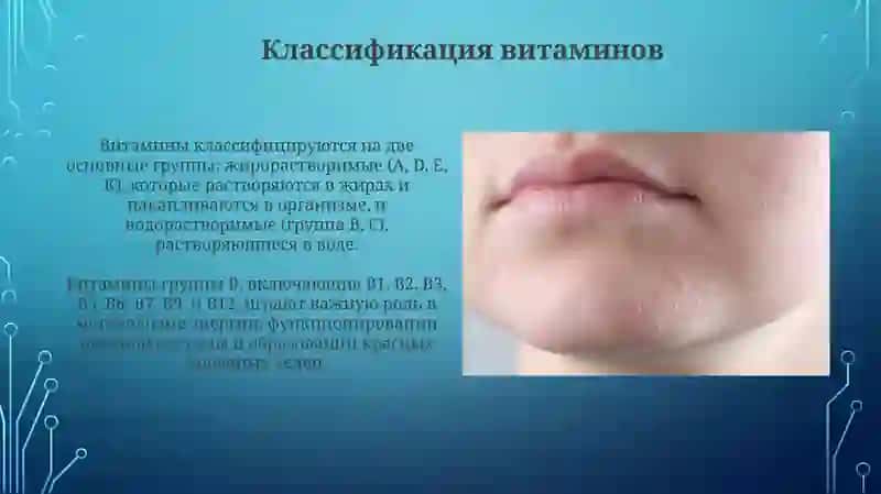 Авитаминозигиповитаминоз 4