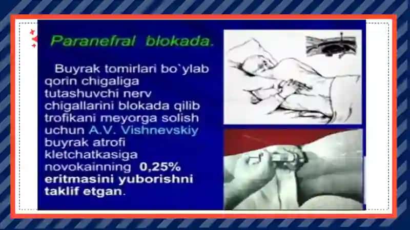 Bel sohasidagi operatsiyalar 4