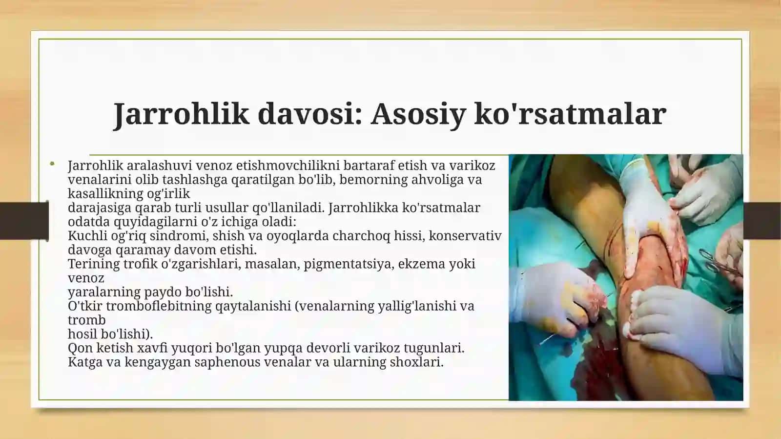 Oyoq venalari varikoz kasalligida bajariladigan operatsiyalar 4