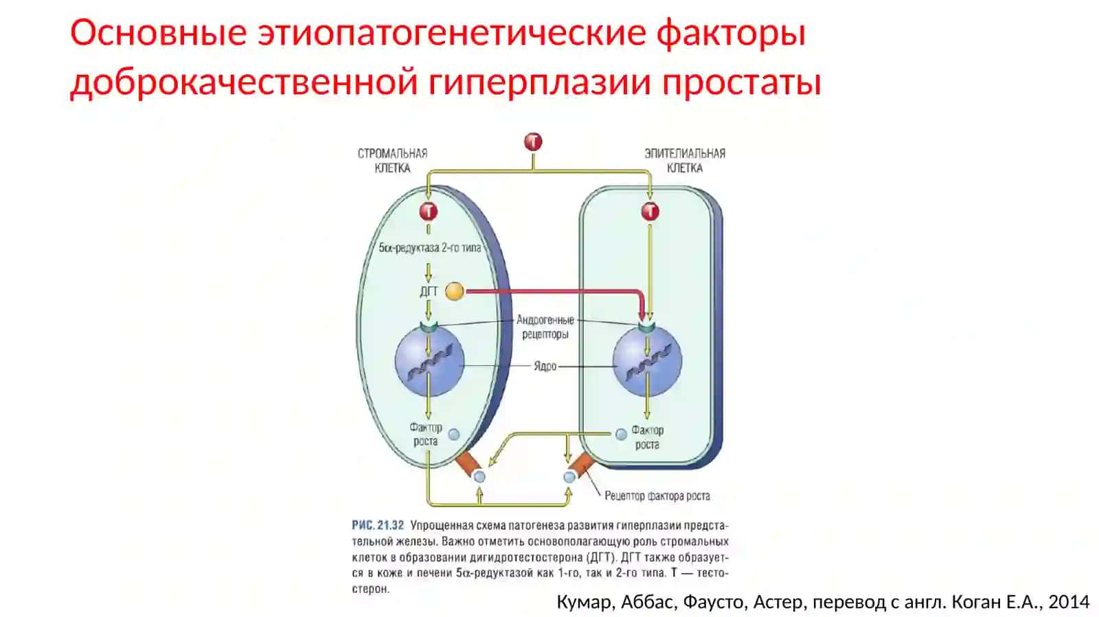 Доброкачественная гиперплазия предстательной железы 4