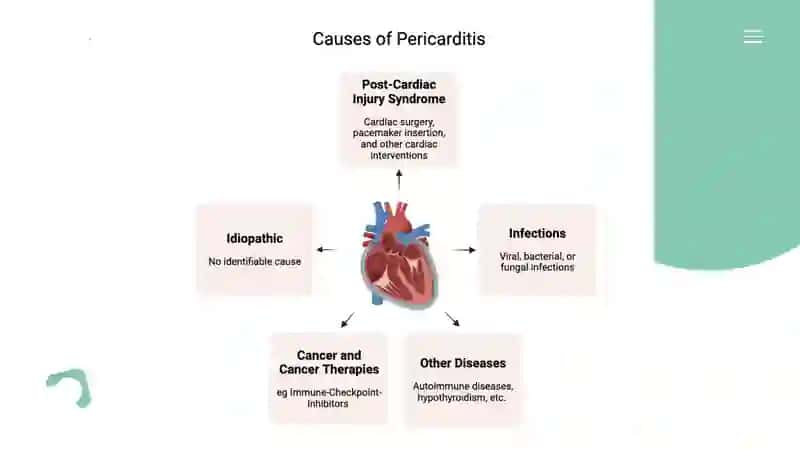 DISEASES OF THE PERICARDIUM. TUMORS OF THE HEART. HEART TRANSPLANTATION. 4