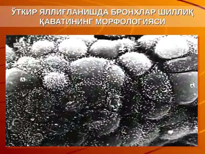 Нафас аъзоларининг афх. ўткир зотижам 4