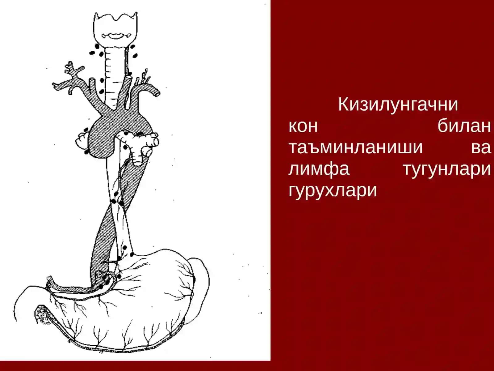 Кизилунгач саратони 4