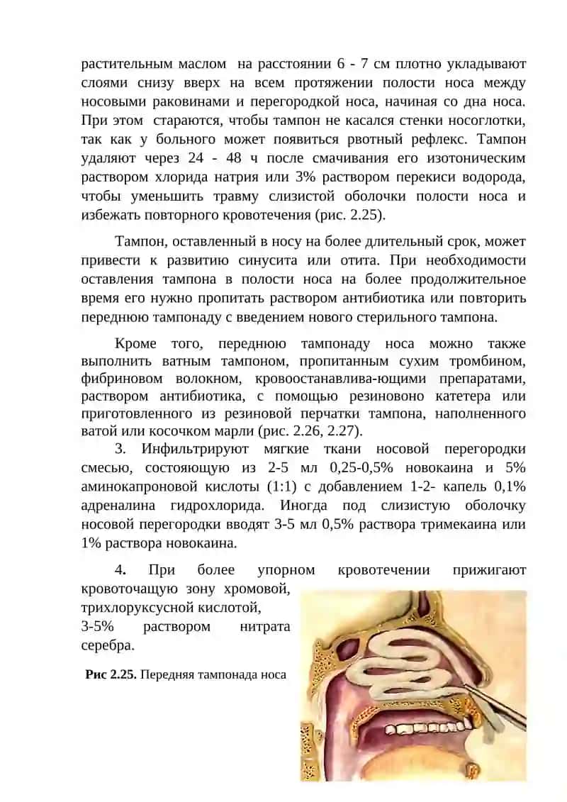 Удаление инородных тел из носовой полости 4