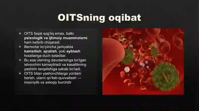 OITS 4