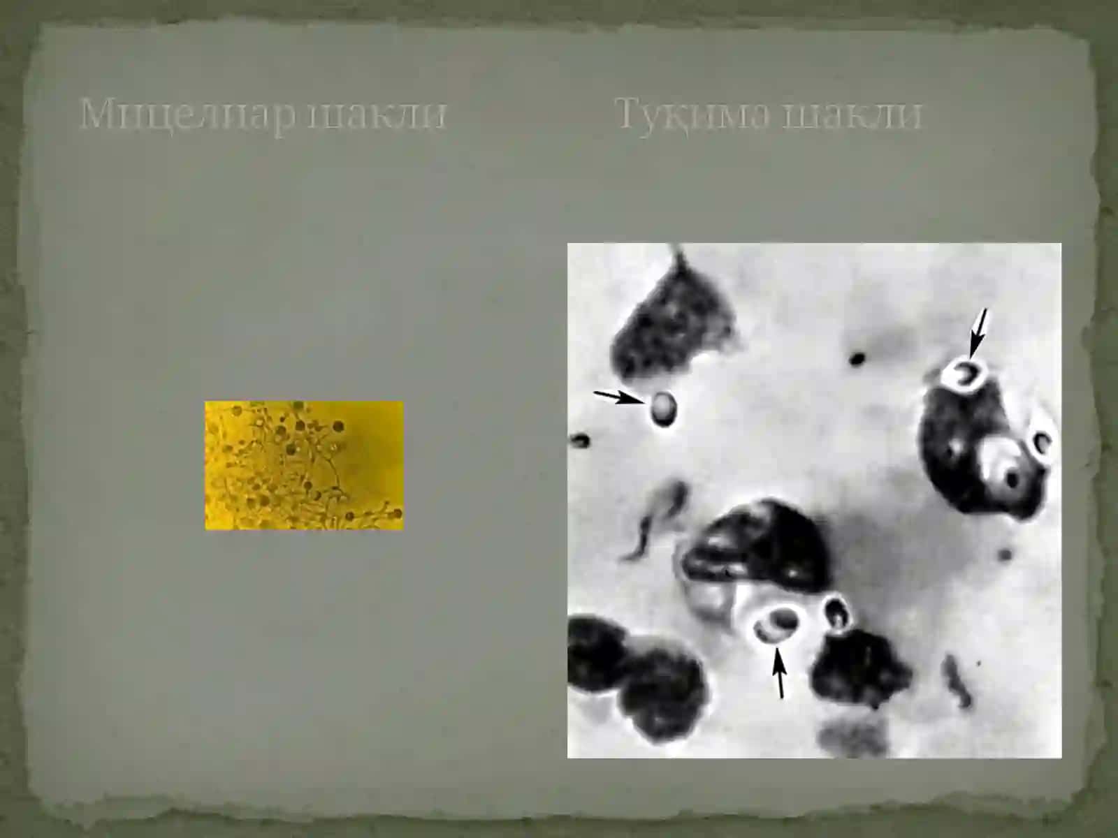 Одамларда чукур микозлар кузгатувчилари 4