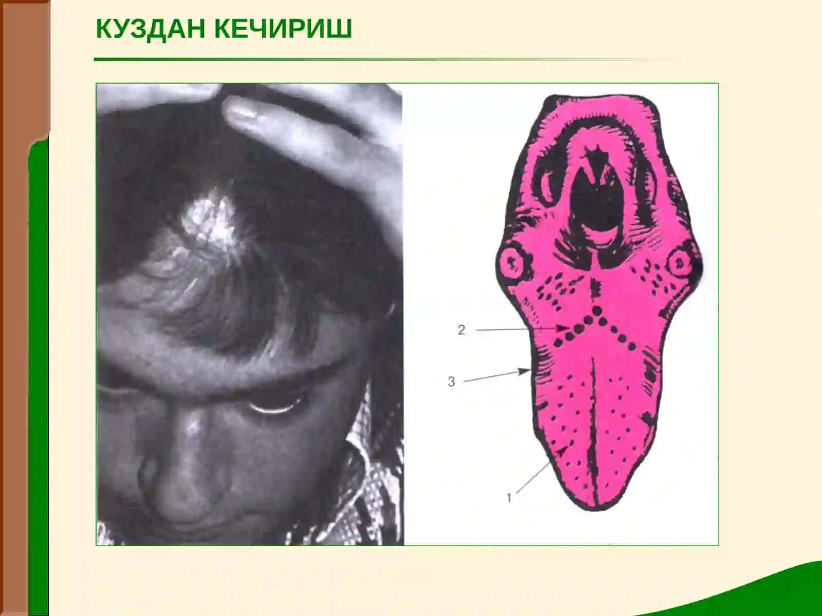 Jigar va oʻt yoʻllari kasalliklari 4