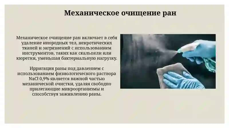 Современные методы физической антисептики 4