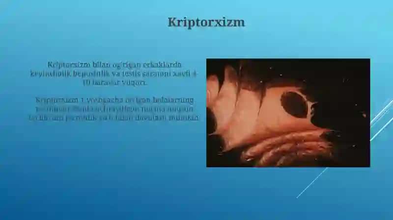 Moyakning yorg'oqqa tushish jarayoni va jinsiy a'zolarning rivojlanish nuqsonlari 4