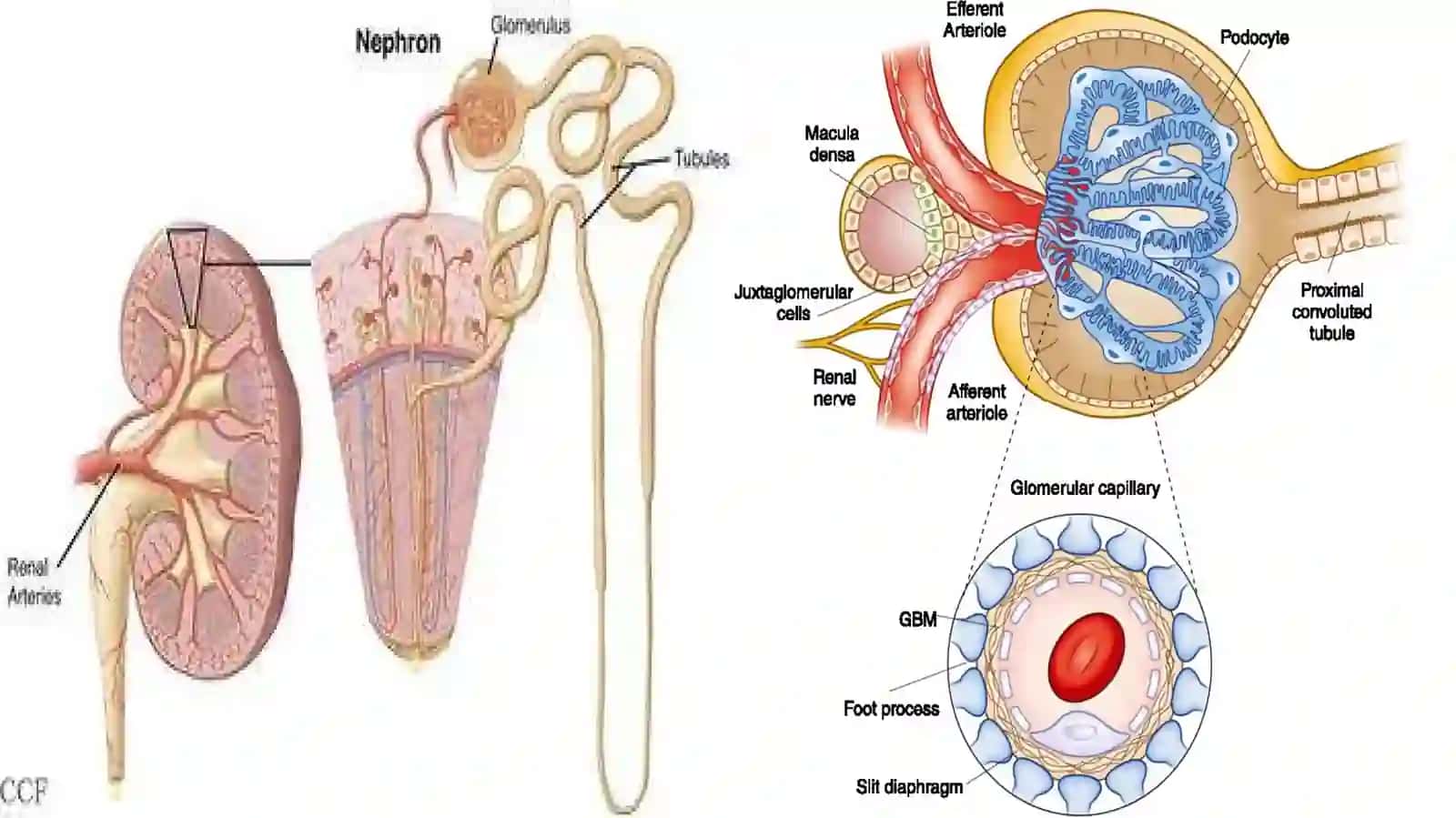 Glomerulopatiyalartushunchasi va umumiy tavsifi 4
