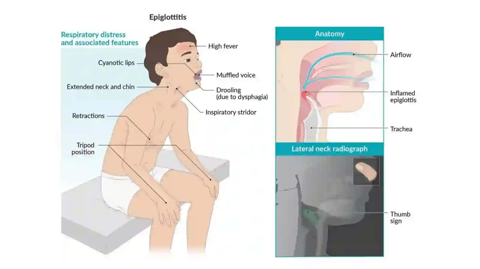 PATOLOGIYA Nafassistemasi patologiyasi 4
