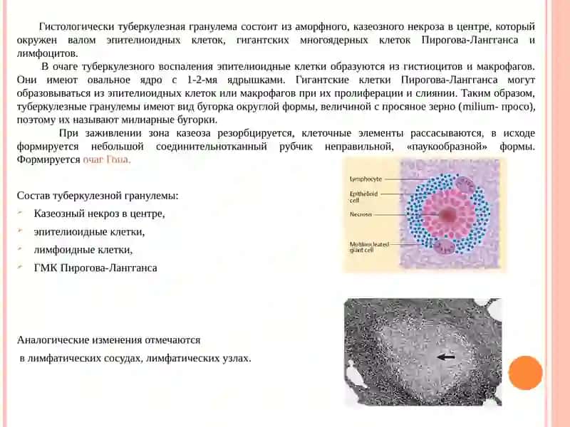 Презентация системные эффекты воспаления, проказа, риносклерома 4