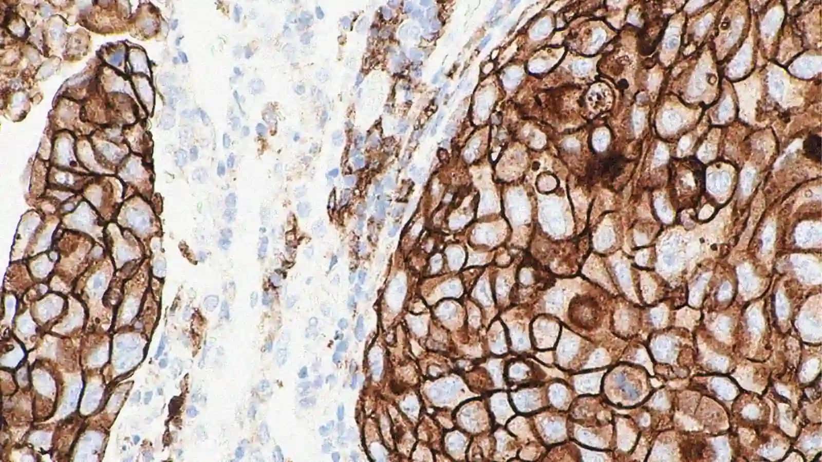 Onkologik kasalliklar, yurak – qon tomir kasalliklari epidemiologiyasi va profilaktikasi 4