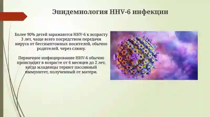 Инфекция, вызванная вирусом герпеса человека 6-готипа 4