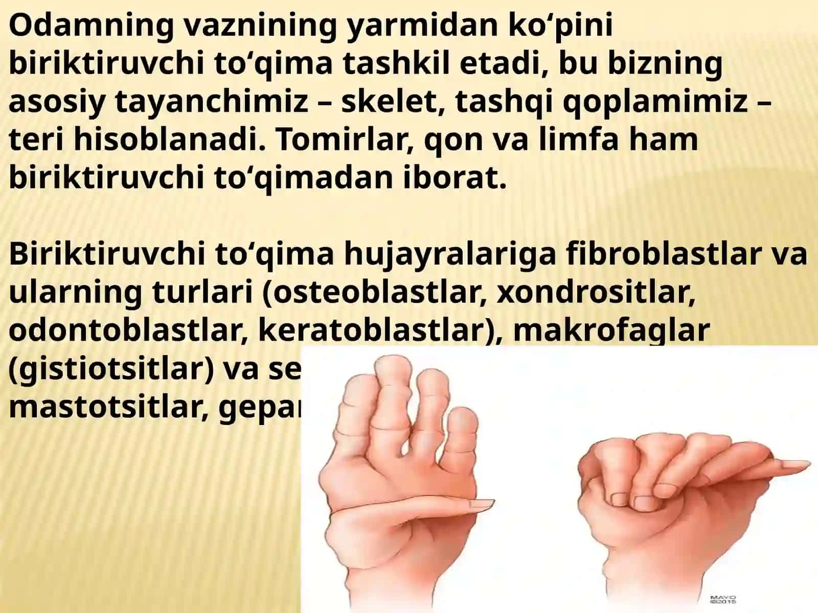 Marfan sindromi 4