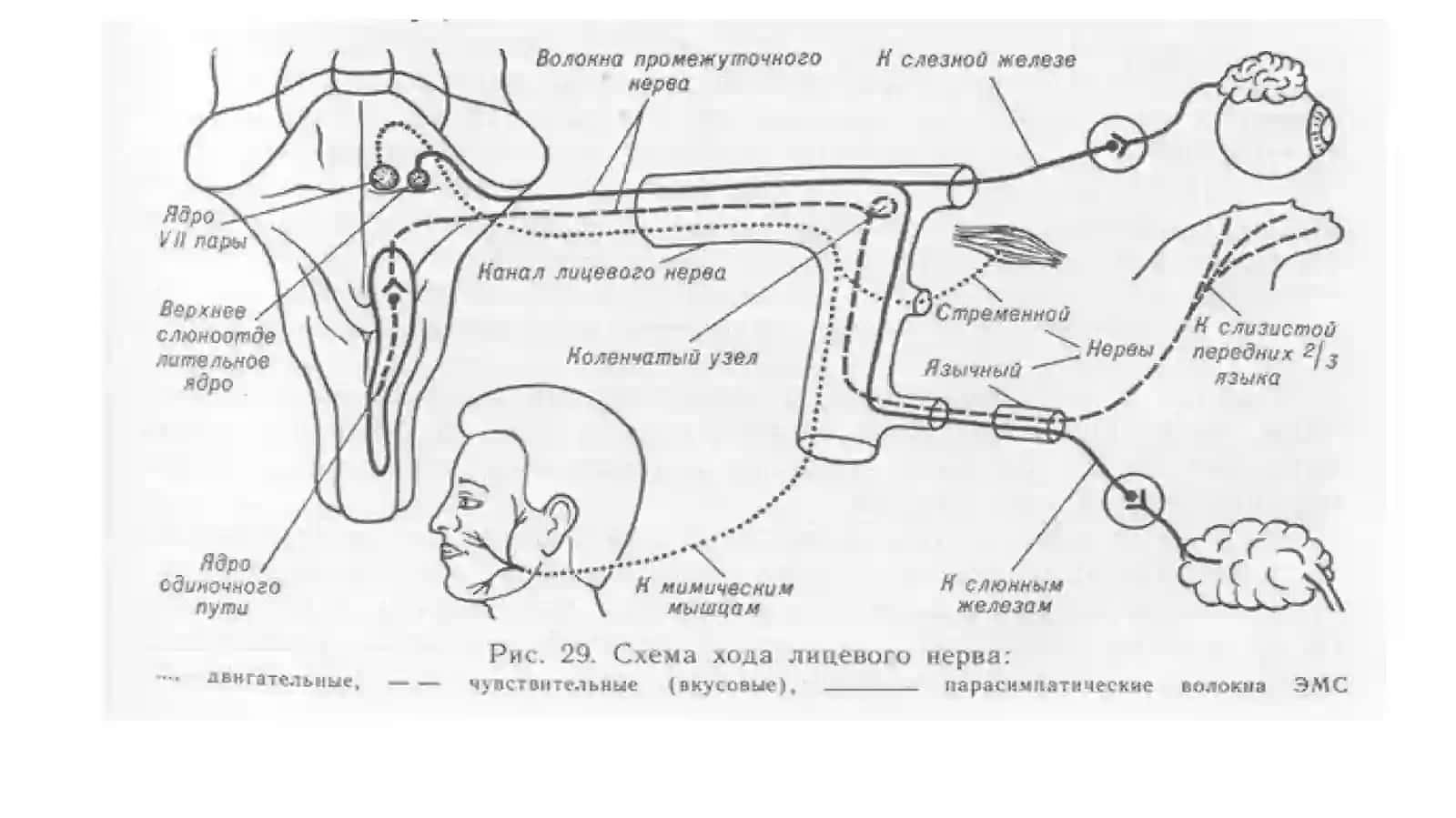 Нейростоматологические синдромы, развивающиеся при поражении лицевого нерва 4