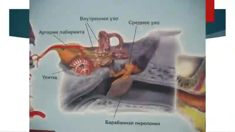Острый и хронический гнойный средний отит 4