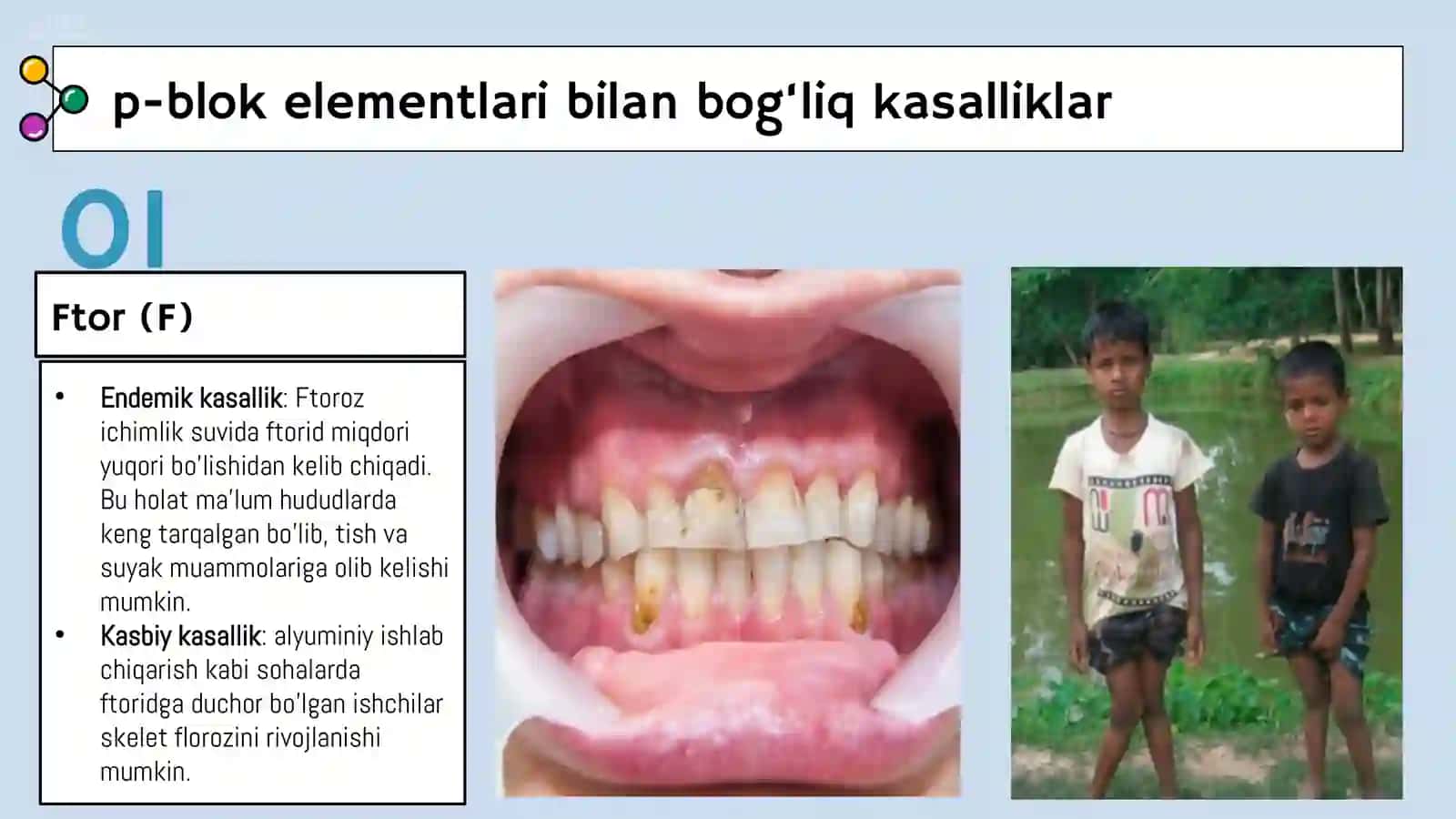 P-blok Elementlari va D-blok Elementlari Endemik Va Kasbiy Kasalliklar 4