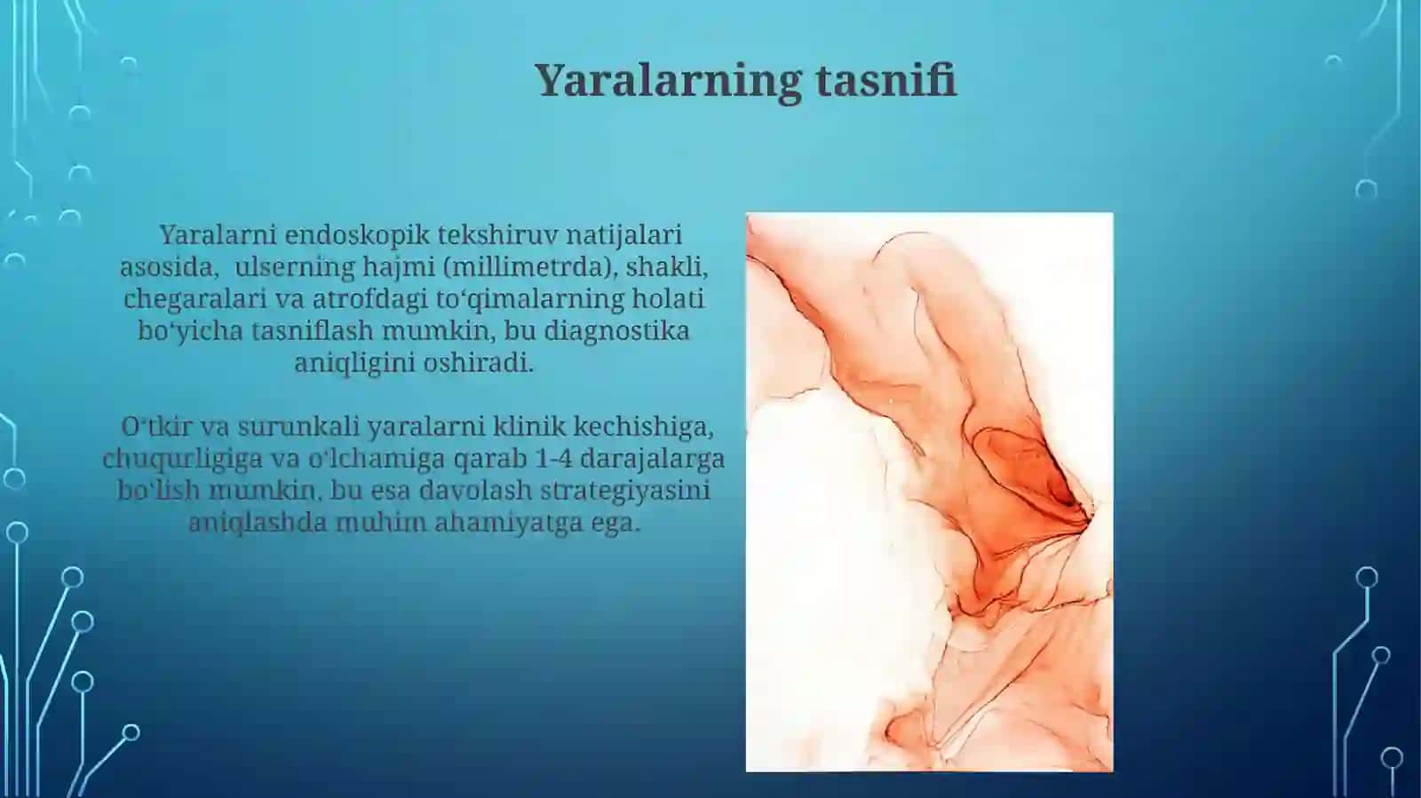 Oshqozon va oʻn ikki barmoqli ichak yara kasalligi asoratlari, diagnostikasi 4