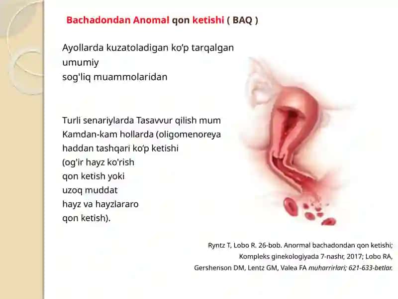 Bachadondan Anomal qon ketishi (BAQ) – FIGO 2018 yangilanishlari bilan BAQ uchun 4