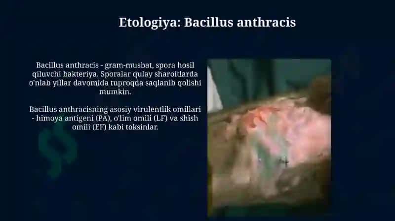 Anthrax - Bacillus anthracis 4