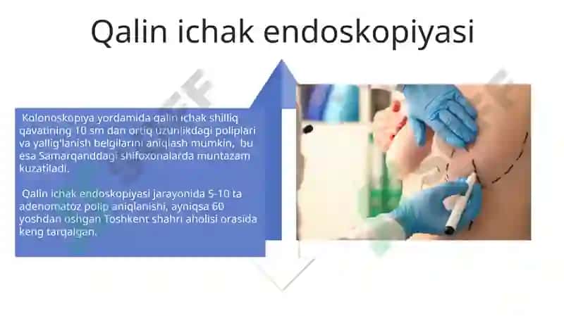 Endaskop tekshiruv usuli 4
