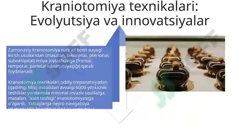 Minimal Invaziv Kraniotomiya Texnikalari 4