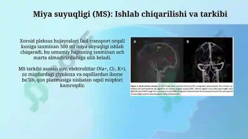 Bosh miya venoz sinuslari va sisternalari 4