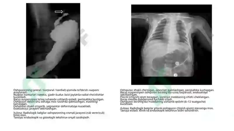 Rentgen tahlillari yig'indisi tibbiy radiologiya 4
