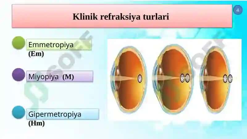 Klinik rеfraksiya 4