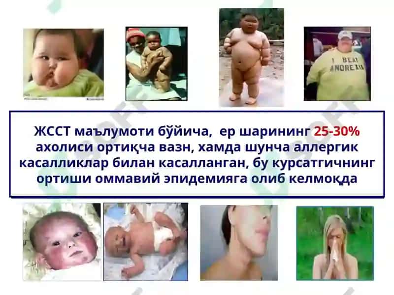 Болалар касалликлари пропедевтикаси 4
