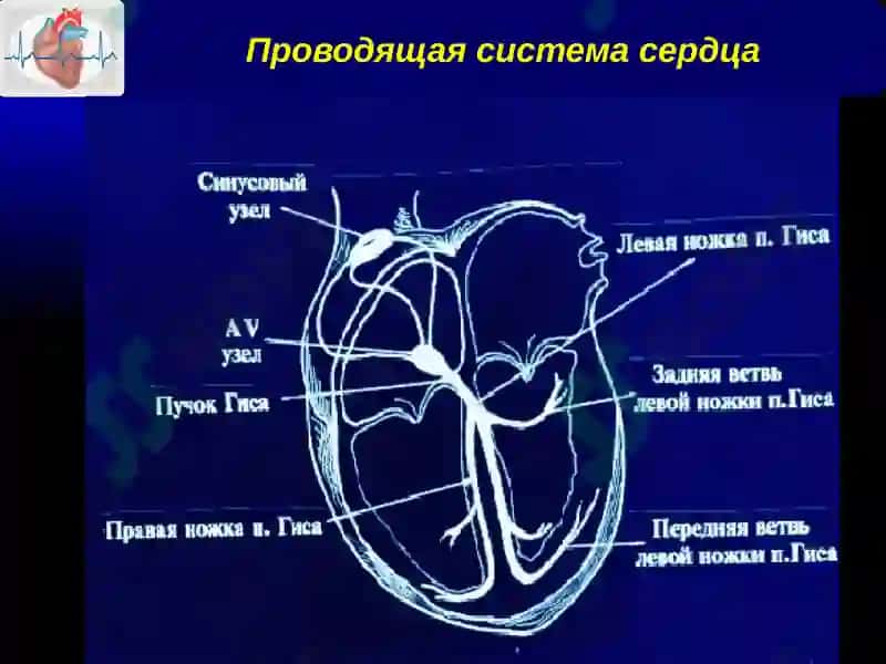 Нарушения ритма и проводимости 4