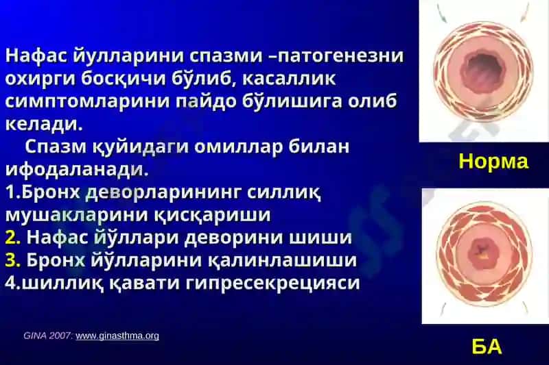 Бронхиал астма 4