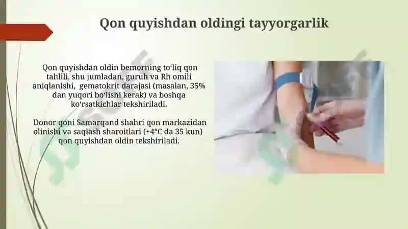 Gemostaz.Qon guruhlari.Rezus faktor.Qon quyish asoslari 4