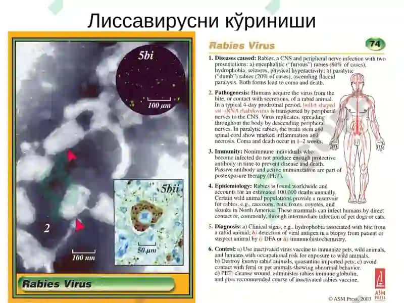 Қутуришкасаллиги ваунгақарши кураштадбирлари 4