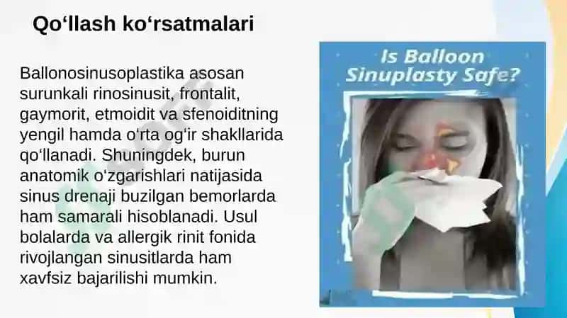 Ballonosinusoplastika 4