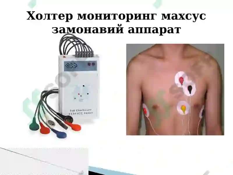 yurakni zamonaviy tekshirish usullari 4