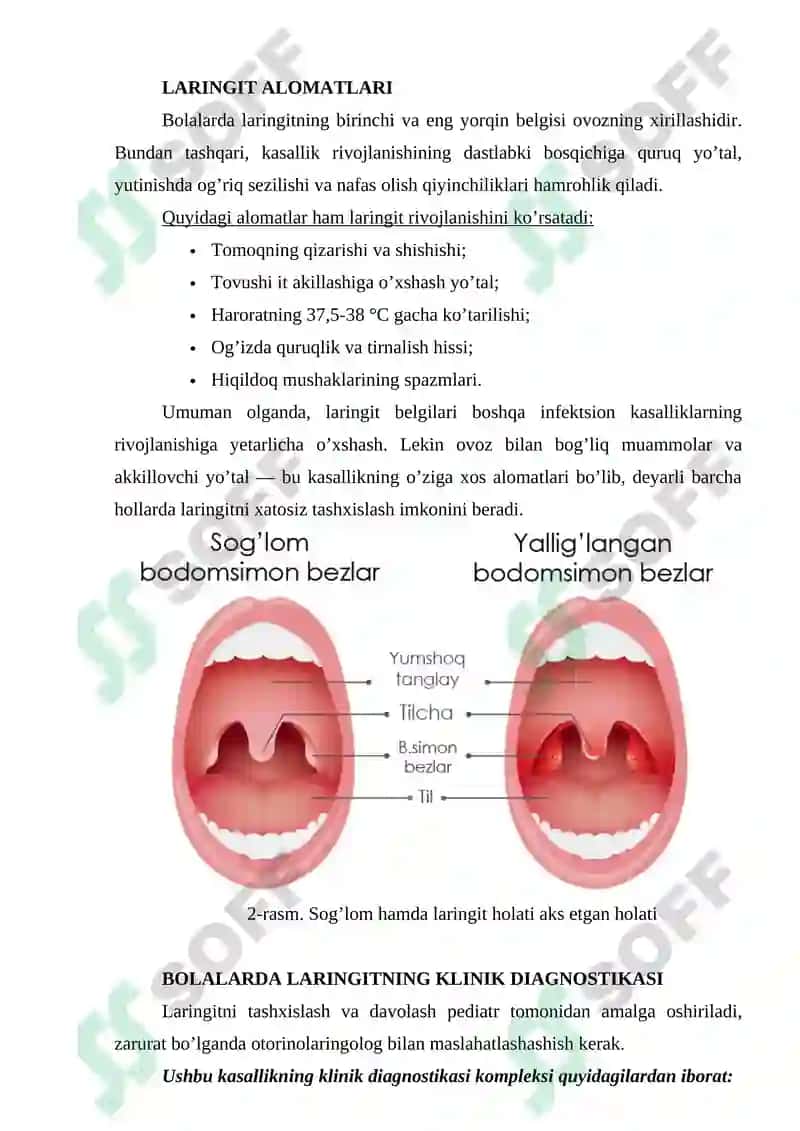 Laringit kasalligi haqida 4