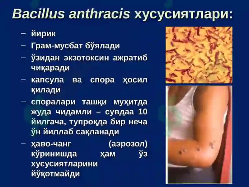 Куйдирги (Bacillus anthracis) 4
