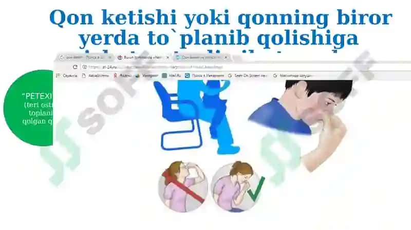 Qon ketish turlari.Qon ketishini to`xtatish usullari 4