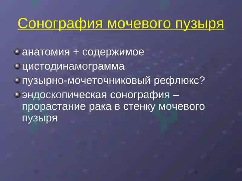 Лучевая диагностика заболеваний почек и мочевыводящих путей 4