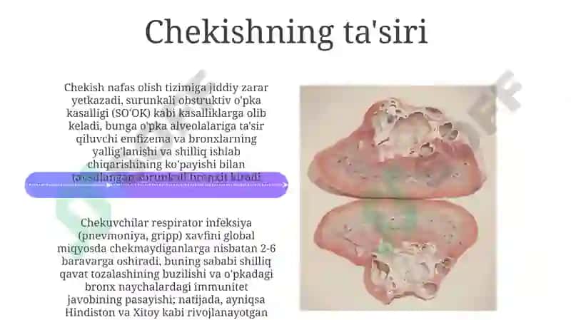 Nafas olish tizimi 4